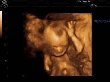 16 week 3D Preview